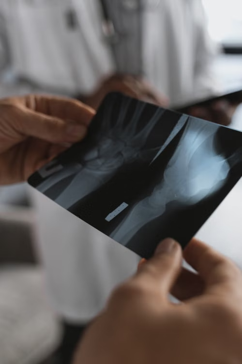 Medical records and timely diagnosis can play a major role in fair accident claim settlements. Medical records and timely diagnosis can play a major role in fair accident claim settlements.